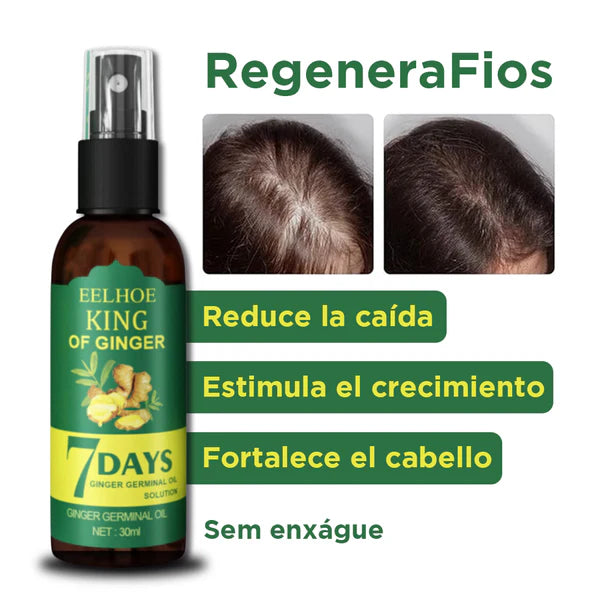 COMPRA 1 LLEVA 2 EELOHE King Of Ginger® 7 Days  Tratamiento Capilar Contra Caida(x2)