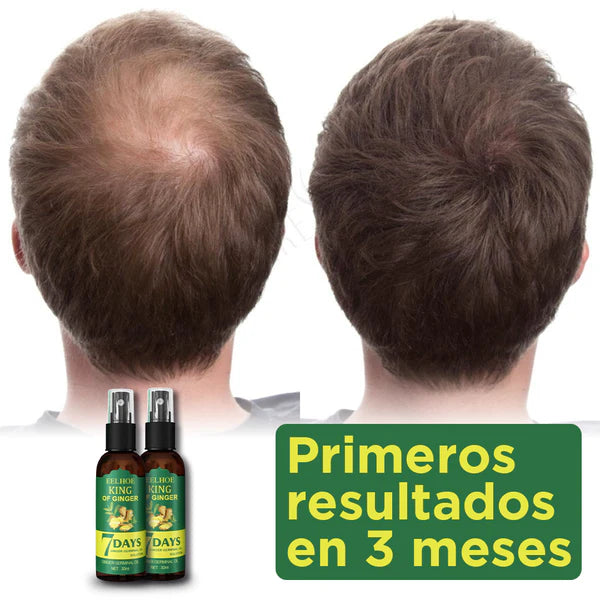 COMPRA 1 LLEVA 2 EELOHE King Of Ginger® 7 Days  Tratamiento Capilar Contra Caida(x2)