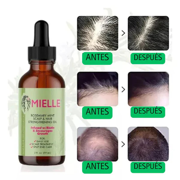 MIELLE® Serum Fortalecedor del Cabello - OFERTA 2X1