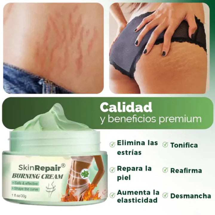 2X1 Crema Antiestrías SkinRepair – Cuida tu Piel, Recupera tu Confianza